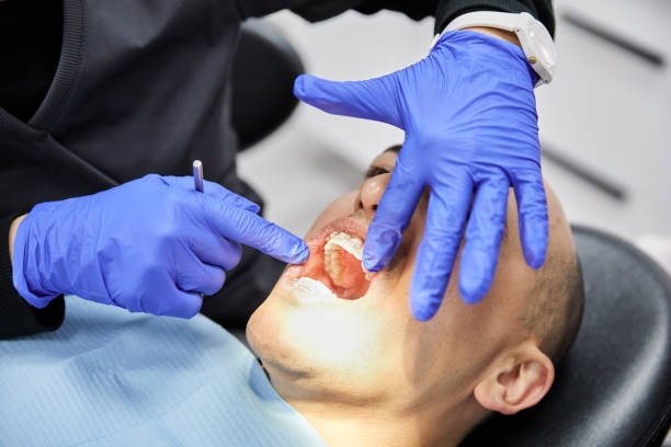 Best Emergency Dental Extractions in Inniswold, LA